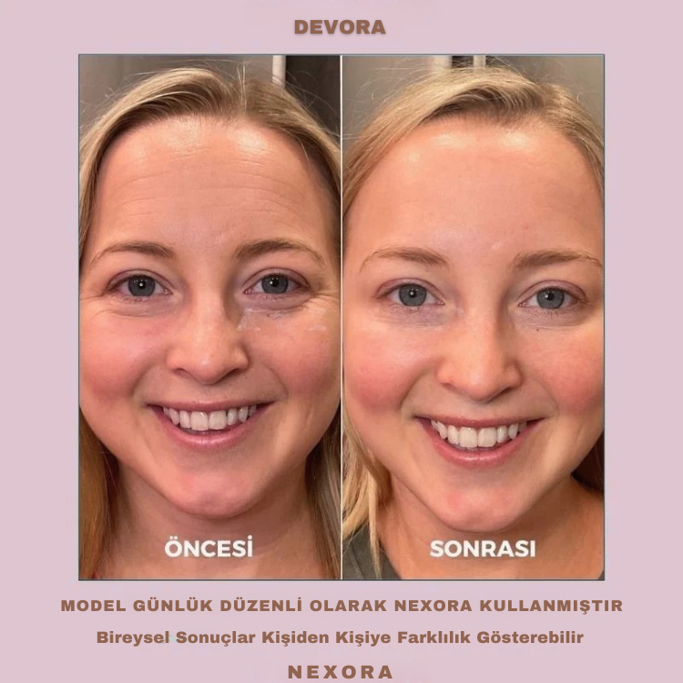 Nexora | LED Işıklı Titreşimli Yüz ve Boyun Sıkılaştırma Terapi Cihazı