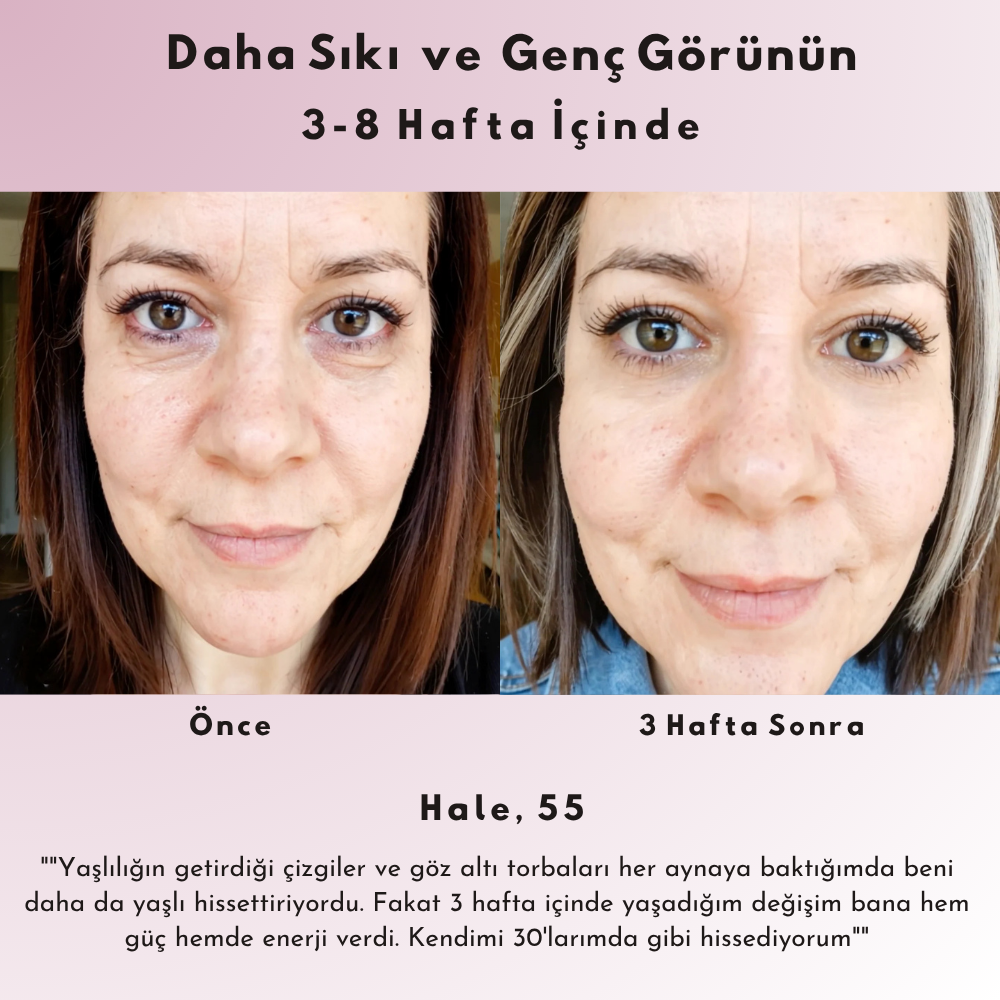 Nora | Gözaltı Mikro Akım Kırmızı Işık Terapi Gözlüğü