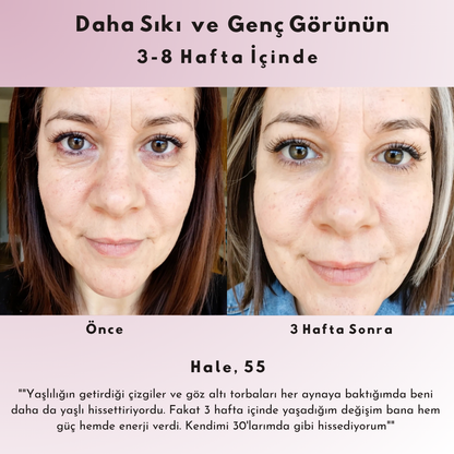 Nora | Gözaltı Mikro Akım Kırmızı Işık Terapi Gözlüğü