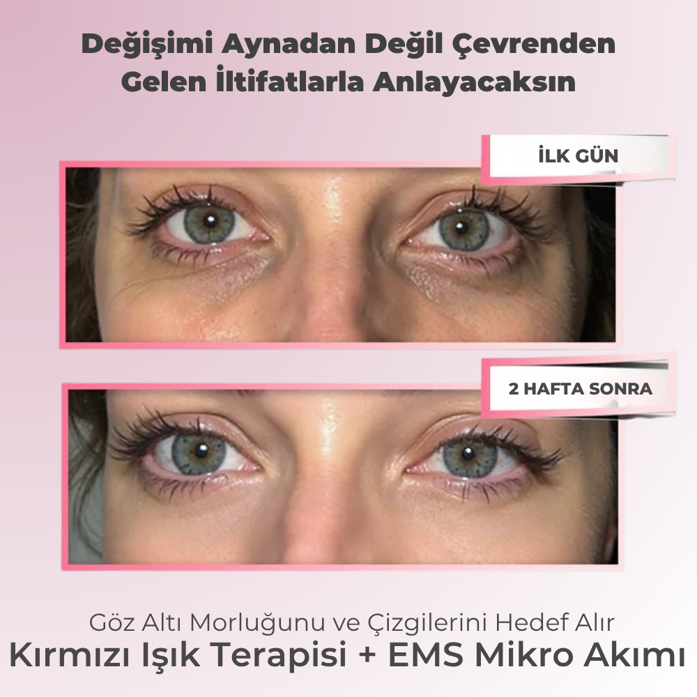 Nora | Gözaltı Mikro Akım Kırmızı Işık Terapi Gözlüğü