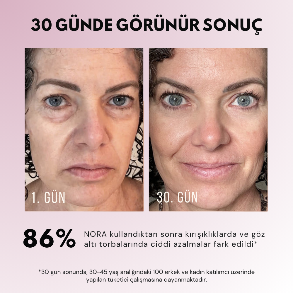 Nora | Gözaltı Mikro Akım Kırmızı Işık Terapi Gözlüğü